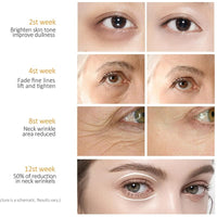 Retinol Eye Cream-Eye Cream For Dark Circles And Puffy Eyes,Anti-Aging Eye Cream With Retinol Serum,Hyaluronic Acid,Retinol Serum-Anti Wrinkle Eye Cream-Moisturising Eye Bags Remover