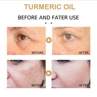 GNAUMORE Turmeric Face Serums Oil,Bright Skin Dark Spot Corrector,Turmeric Serum, Skin Care Moisturizing Repair Serum for Face and Body(30ML)