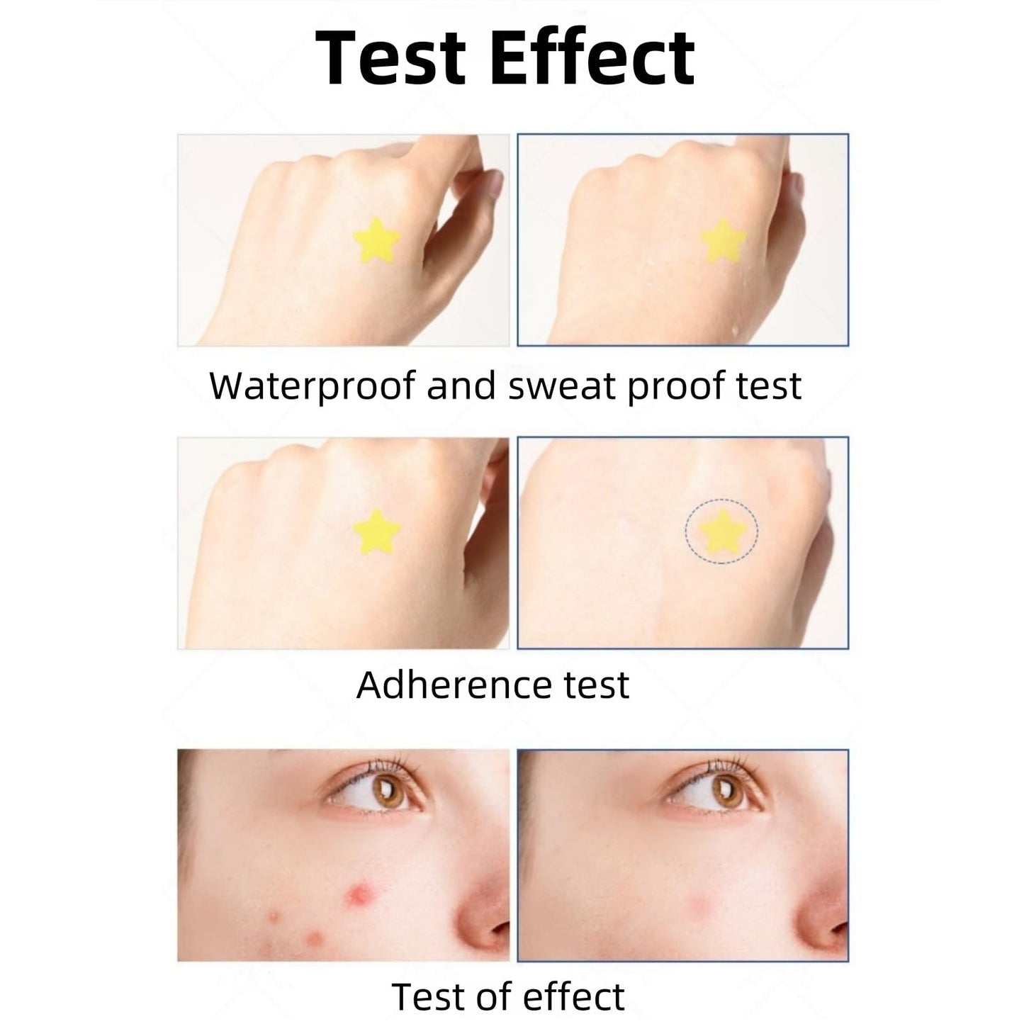 GUOUURR Star Hydrocolloid Pimple Patches - PE Water Colloid Acne Stickers, Thin Lightweight Concealing Dots with Cute Star Design, 32pcs Portable Acne Patches for Teens & Adults, Invisible Spot Treat