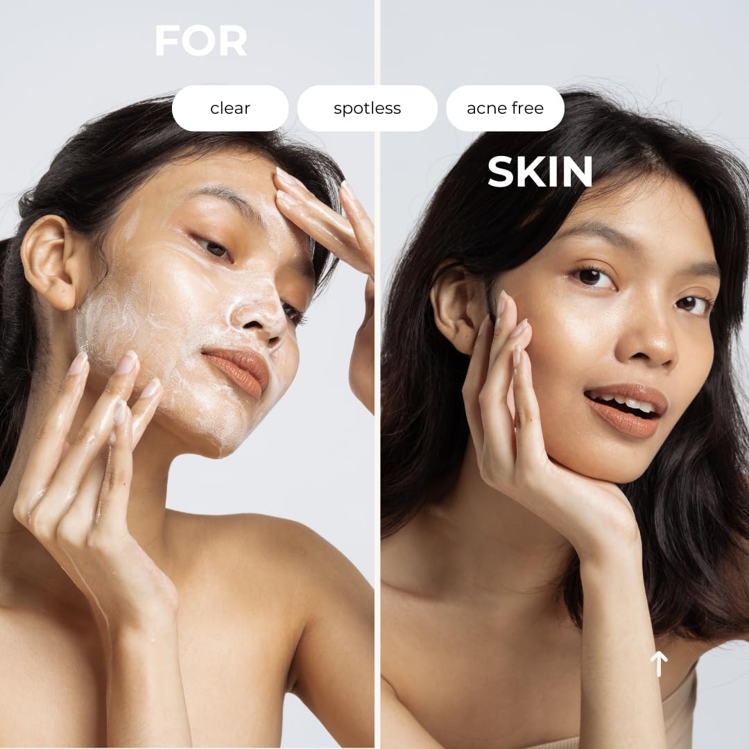 hollywoodskin Organic Salicylic acne cream. 4X STRONGER, 11X FASTER! Patented technology features Hyaluronic Acid (5%), Vitamins A and C + Tea Tree Oil. Target Blemishes. 50ml