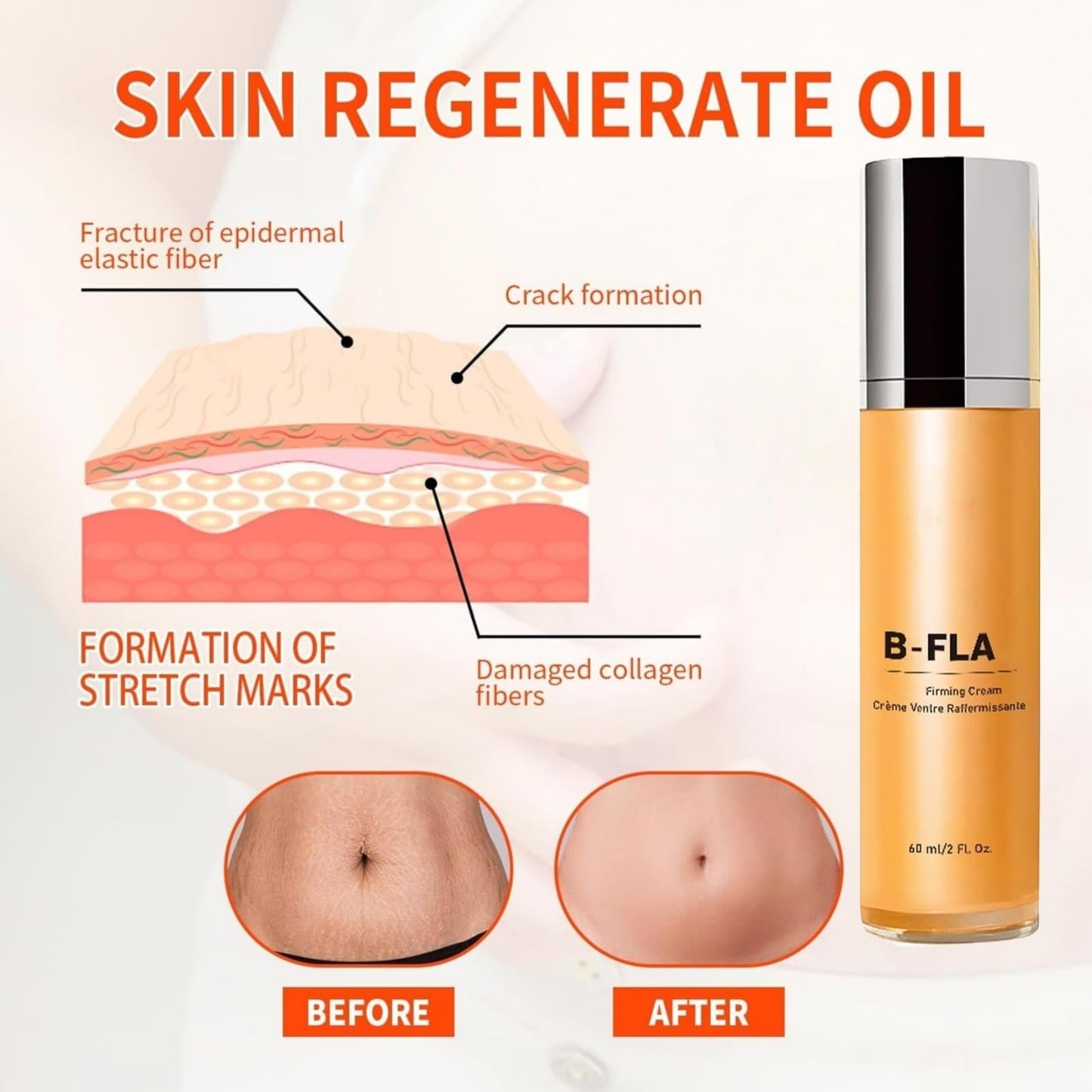 SingHao B Fl/at Belly Firming Cream,Stretch Mark & Scar Treatment Skincare Cream,Skin Firming and Tightening Body Cream,Skin Tightening Moisturizing,Skin Regenerate Cream,Stretch Marks Removal