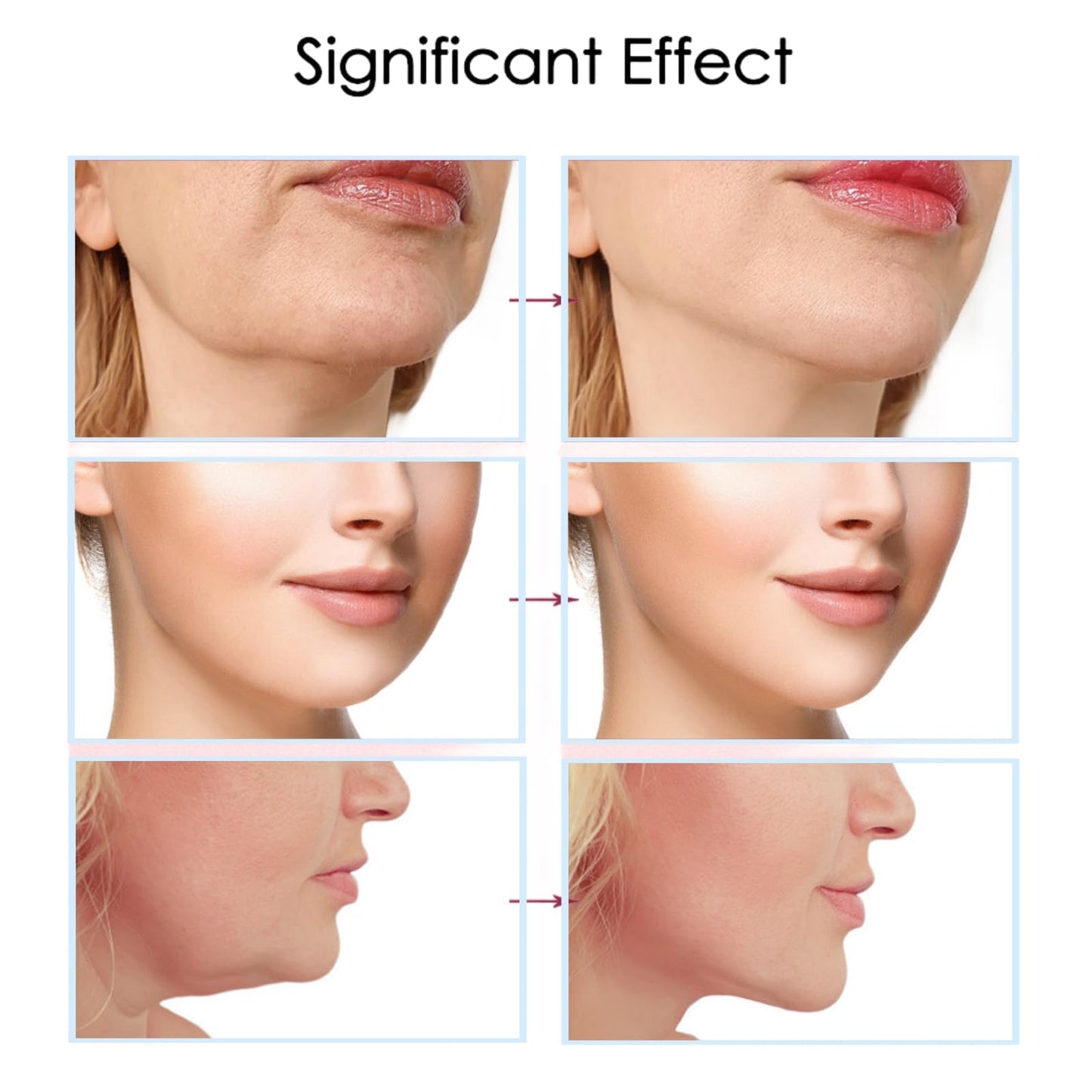 100PCS Face Lift Tape Invisible,Face Lift Tape,Face Tape,Anti Wrinkle Patches,Face Lift Stickers,Elasticity Tighten Lift Patches,Facial Wrinkle Patches,Face Tape for Wrinkles,Face Lifting Tape