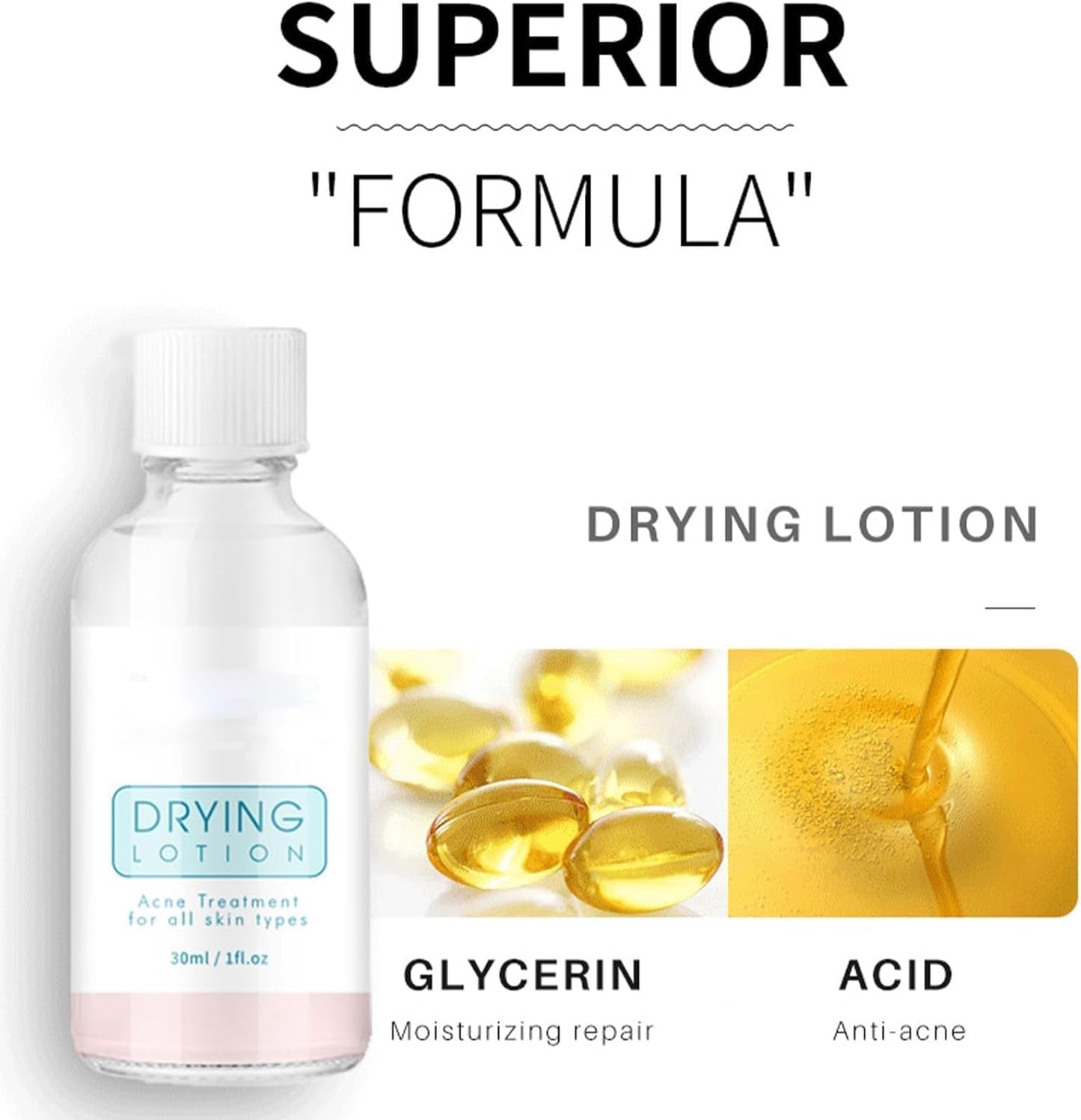 Eveloveu Anti-Acne Serum & Drying Lotion – Fast-Acting Acne Treatment to Dry Out Blemishes, Reduce Pimples & Redness. Gentle Acnecide Face Lotion for Teenage Girls, Women & Men – Clear, Healthy Skin Care