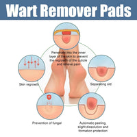 24Pcs Verruca Treatment Corn Plasters,Wart Remover,Corn Remover for Feet and Hand,Gentle and Safe Verruca Plasters,Wart Removal Patches,Foot Care for Women and Men,Pain Relief,Gentle and Skin-friendly