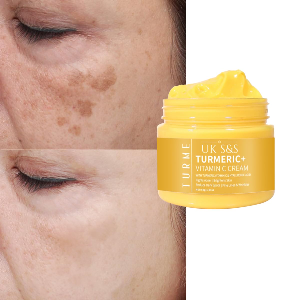 Turmeric & Vitamin C face cream. Anti-aging cream that reduces dark spots and brightens skin. Heals acne and repairs damaged skin. Soften and smoothens skin.