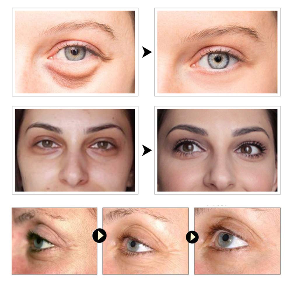 Nuonove Under Eye Mask, Collagen Eye Mask, Under Eye Patches, Eye Pads, Anti Aging Eye Patches with Collagen, For Brightens & Reducing Wrinkles, Dark Circles, Eye Bags and Puffiness/30 Pairs