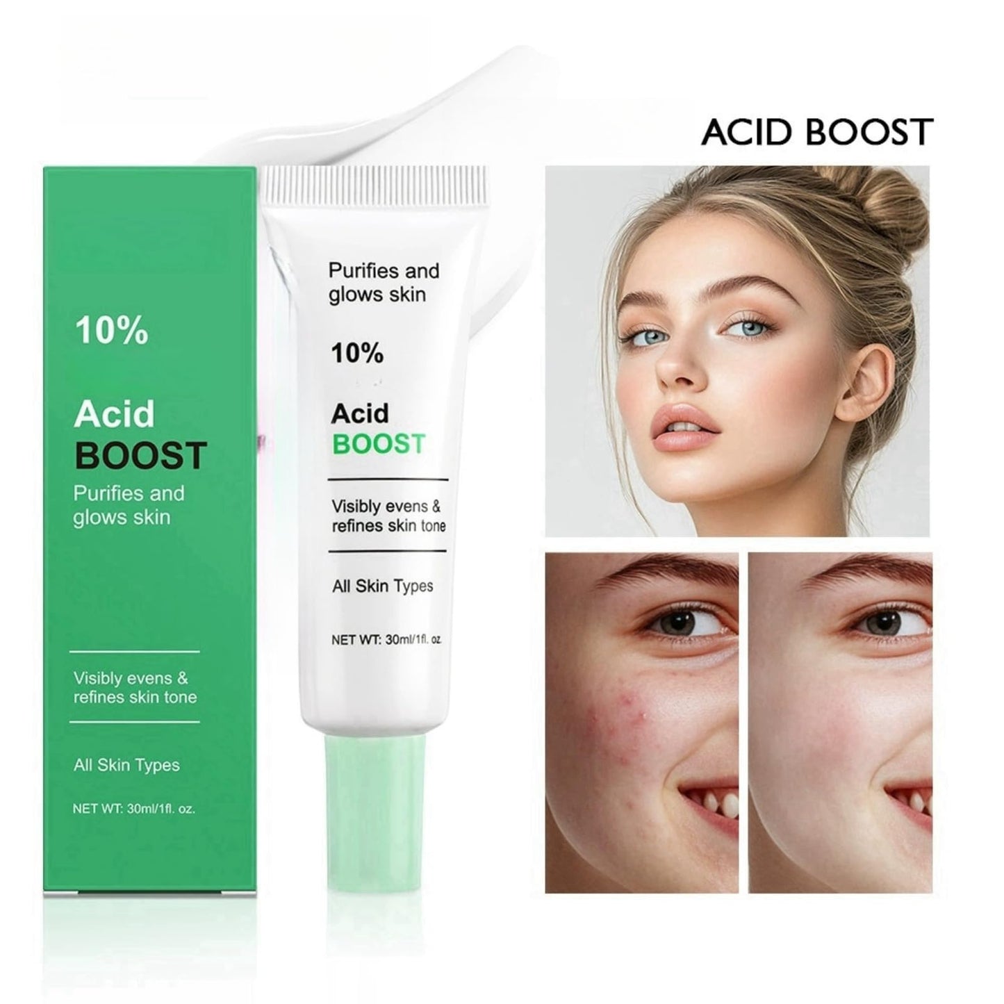 Oumun 10% Azlaic Acid Booster Cream Gel,Azlaic Acid Cream for Face,A/zlaic A/cid Cr/eam 10%,A-zlaic Ac-id Gel,Acne Treatment Cr-eam,Acne Cre-am,Skin Tightening Crea-m for Fa-ce,Azlai-c Aci-d Serum