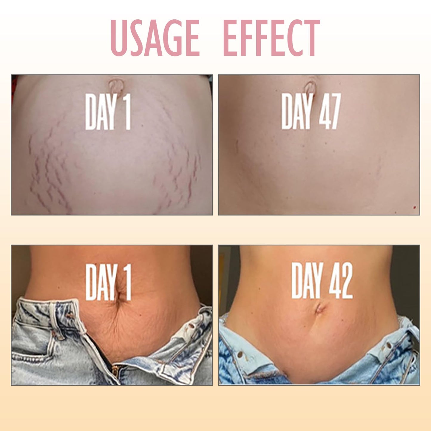 Belly Firming Cream - Skin Tightening Cream Body Firming, Tightening & Hydrating for Tummy, Thighs, Arms & Butt Firms & Tones Sagging Skin for a Smooth, Youthful Glow