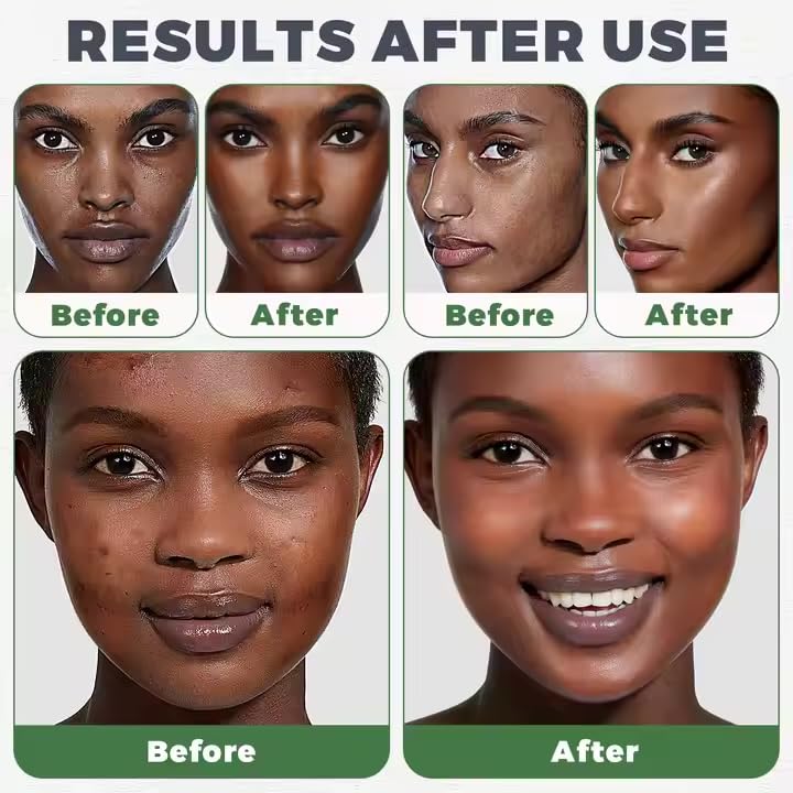 100% Natural African Black Soap | Skin Brightening & Black Spot Removal Unprocessed, Handmade, | Anti-Ageing, Acne Care, Deep Hydration & Moisturizer | Ethically Sourced for All Skin Types