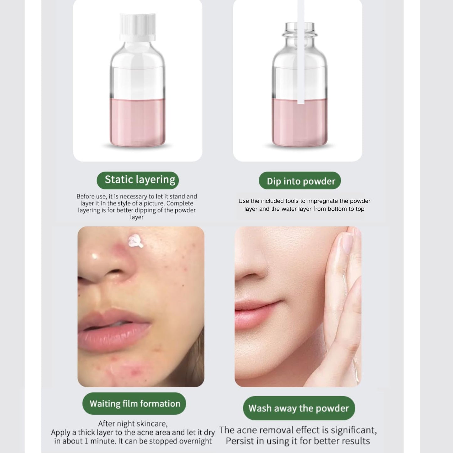 Cureluxe Anti Acne Serum - Acne Drying Lotion – Fast-Acting Blemish & Spot Treatment - Face Serum to Reduce Redness & Pimples - Dry Out Pimples,Clean Pores - Teen Girls, Women & Men Skin Care