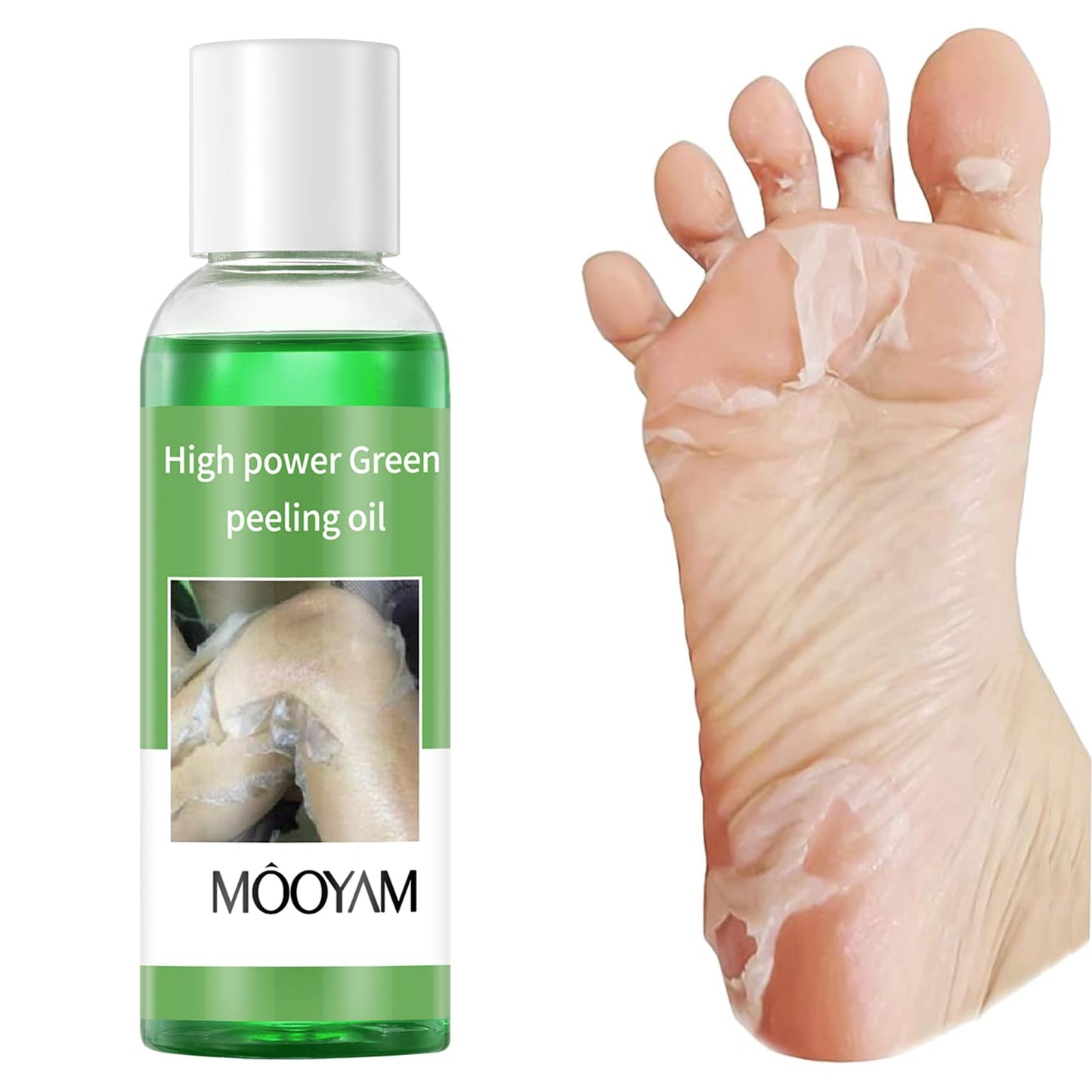 Exfoliating Green Peeling Oil for Extra Strength Exfoliation, Exfoliating Peeling Solution for Body and Face Skin Peeling Chemical Peel At Home