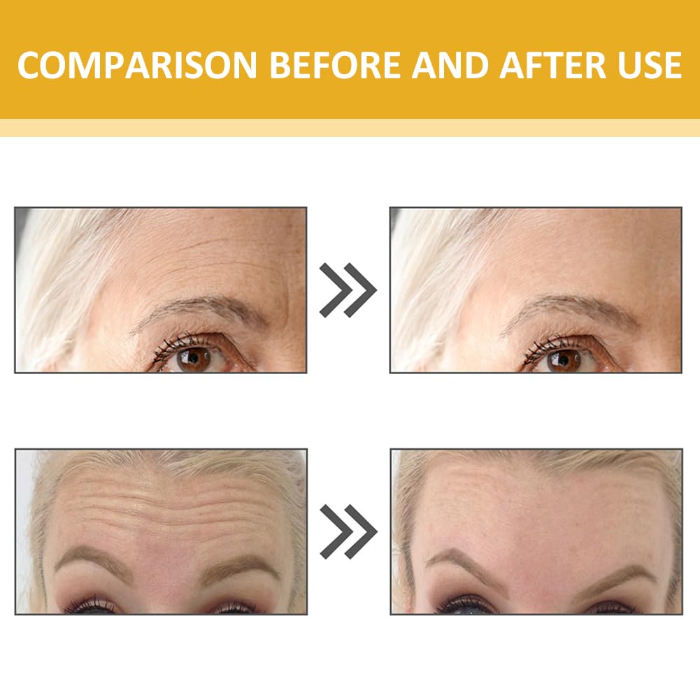 Forehead Wrinkle Patches,12pcs Collagen Forehead Anti Wrinkle Patches,Anti Wrinkle Patches,24k Gold Forehead Face Smoothing Forehead Patches,Anti Wrinkle Tighten Skin