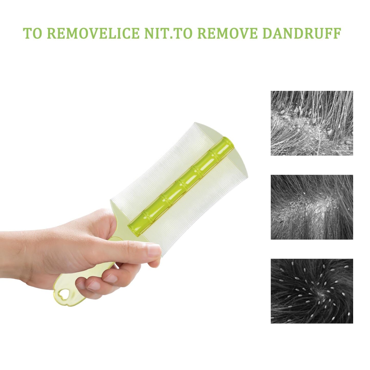 Generic 2Pcs Dandruff & Lice Comb - Psoriasis, Fine Tooth, Head Lice & Dandruff Remover for Removal of Fleas, Lice, Dandruff and Tangled Hair (Green)