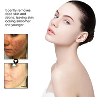 Siyinzu 100g Recovery Mud Mask,Recovery & Relief Clay Face Mask,Deep Cleansing Relief Mud Masks,Cleansing Oil Korean Mud Masks,Deep Pore Cleanser Face & Body Mask,Face Mask Soothing & Nourishing