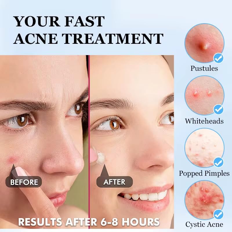 Generic Pimple patch