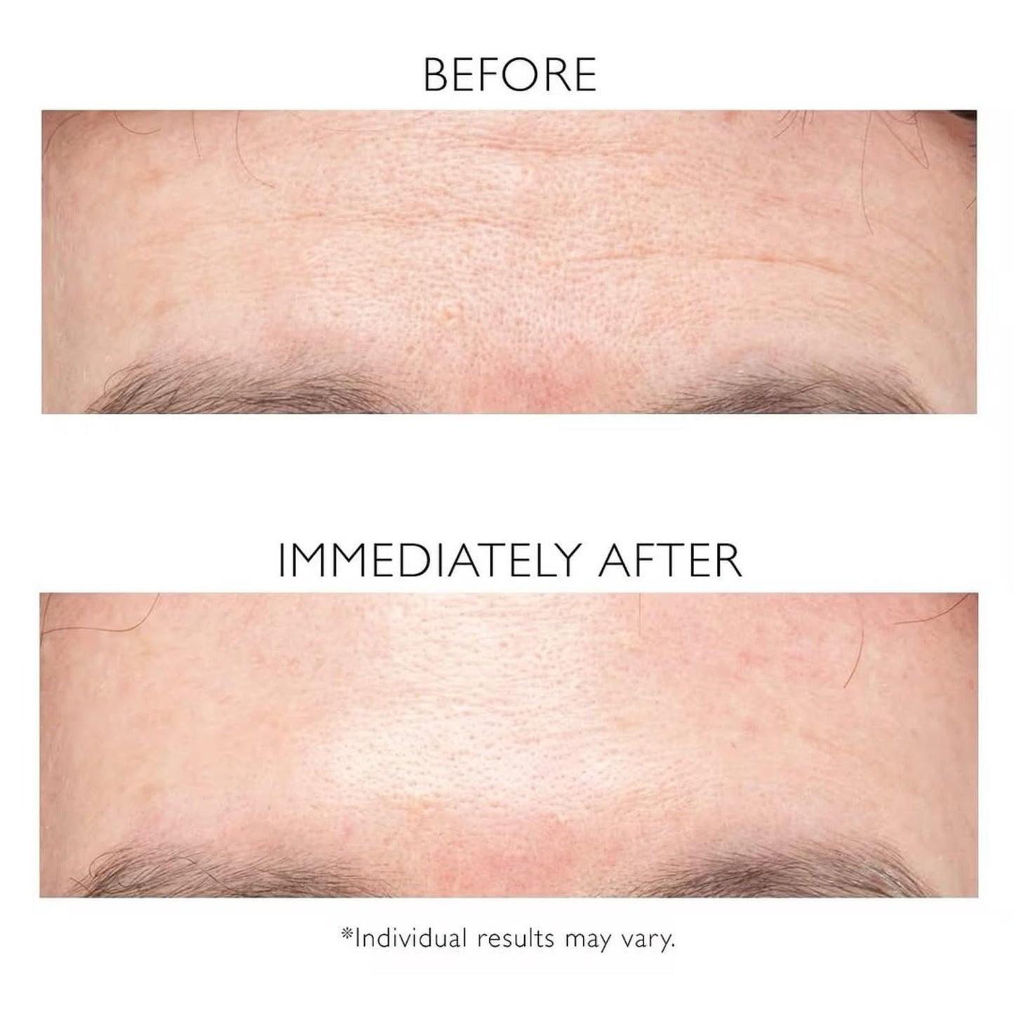 Instant Firmx Temporary Face Tightener, Skin Tightening Cream For Face, Face Tightening Cream, Anti Wrinkle Face Cream For Mature Skin, Firm & Smooth The Look Of Fine Lines, Reduces Sag & Dull