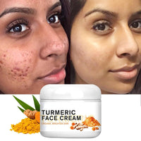 Turmeric Face Cream Skin Whitening Brighten the Skin Shrink Pores Treat acne Moisturizing Facial Cream For All Skin Types 50ml