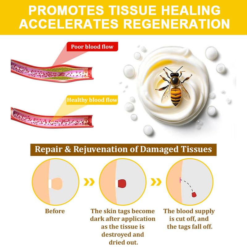Trendyfave Bee Venom Cream, Bee Venom Skin Treatment Cream, Skin Repair, Enriched with Bee Venom & Natural Extracts, Body Moisturiser, Revitalises Skin, Suitable for All Skin Types, 2Pcs