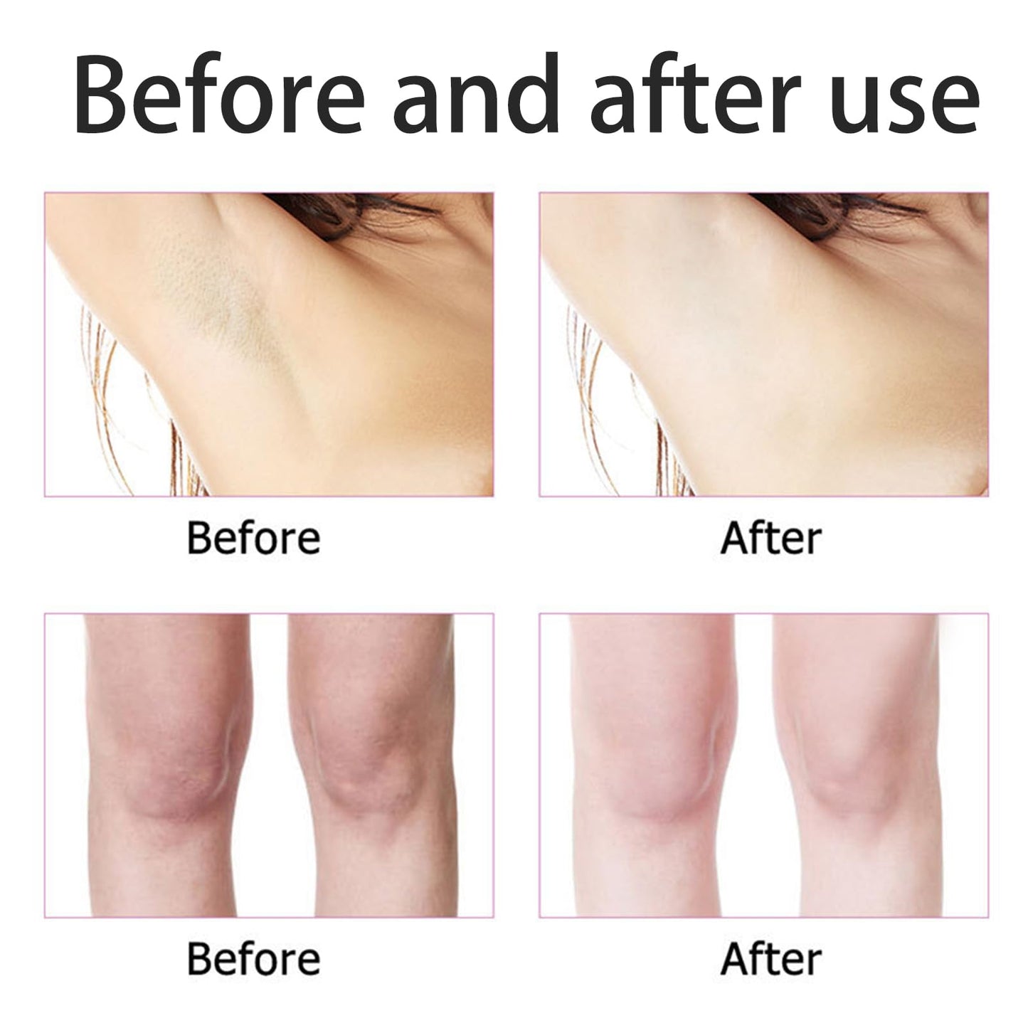 Korean Skin Care, Kojic Acid Skin Cream, Skin Bleaching Cream for Armpit, Knees And Elbows, Elbows, Inner Thigh, Bikini Areas, Underarm Whitening Products Quickly Absorb & Reduce Odor, Smoothing