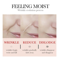 Wrinkle Patches – Microcrystalline Nasolabial Folds Improvement, Anti-Aging Lift Tape for Smooth, Invisible Wrinkle Improvement. Reusable & Gentle