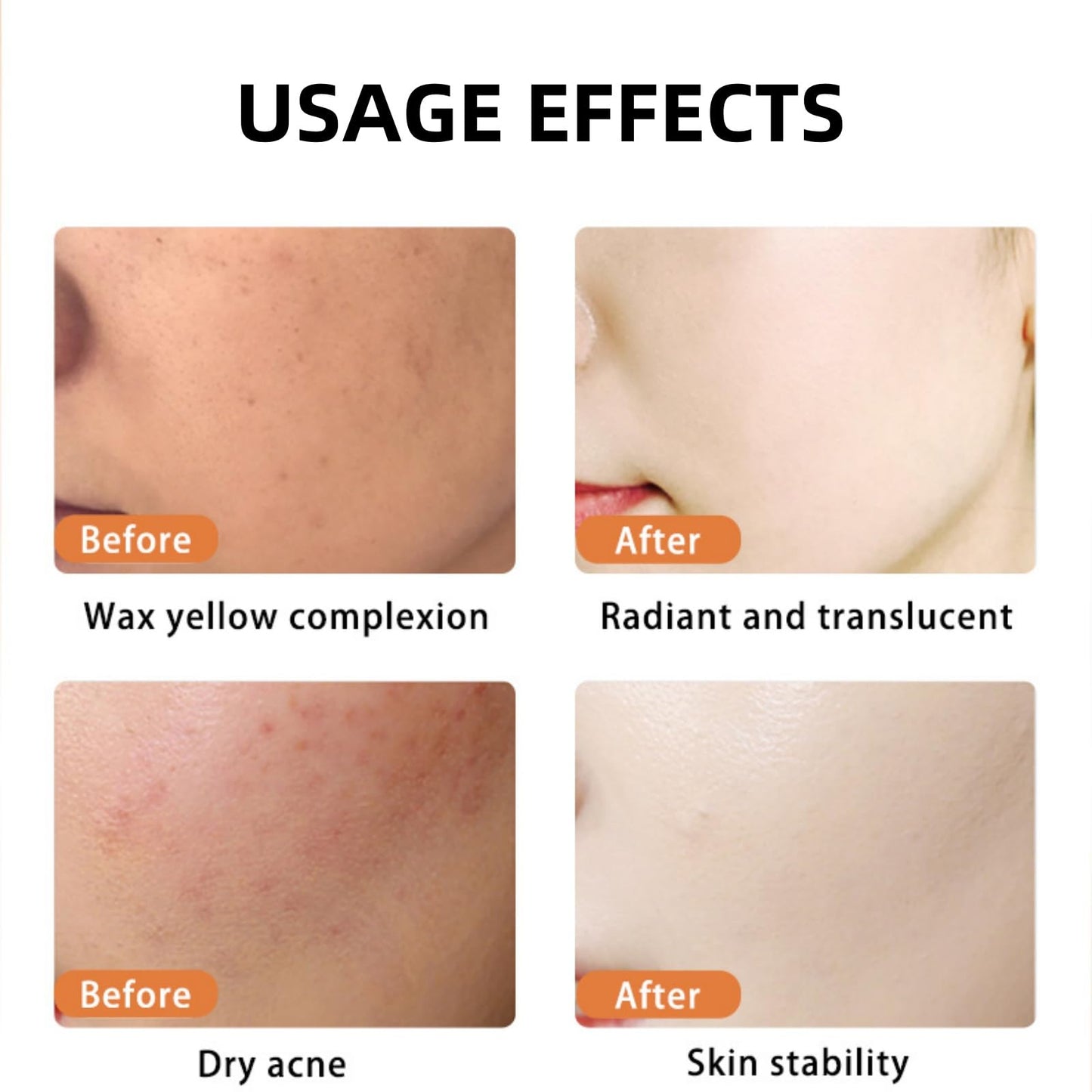20% Vitamin C Serum Face,Anti-Aging Face Serum,Anti Wrinkle Facial S/erum,Vit C S/erum,Collagen Boosting and Skin Brightening Facial Se/rum,Brighten Hydrate F/ace Se/rum,F/ace Moisturiser,30ml