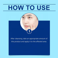 Retinol Gel,Acne Treatment Gel,Acne Control Cream for Face,Anti Acne Gel for Spot Prone Skin,Retinol Moisturizer Cream,Brightens Skin and Improves Elasticity,Face for Pimple Reduce,Without Over Drying