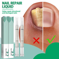 2 Pack Nail Repair Pen, 4ml Nail Care Liquid - Nail Strengthener, Cuticle Oil, Help Strengthen The Nails