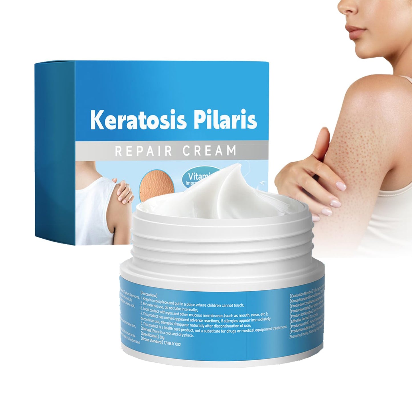 Strawberry Legs Treatment Body Cream,Keratosis Pilaris Cream Treatment with Vitamin E and Urea,Skin Exfoliating Repair Cream for Chicken Skin Treatment,Eliminates Strawberry Spots(30G)