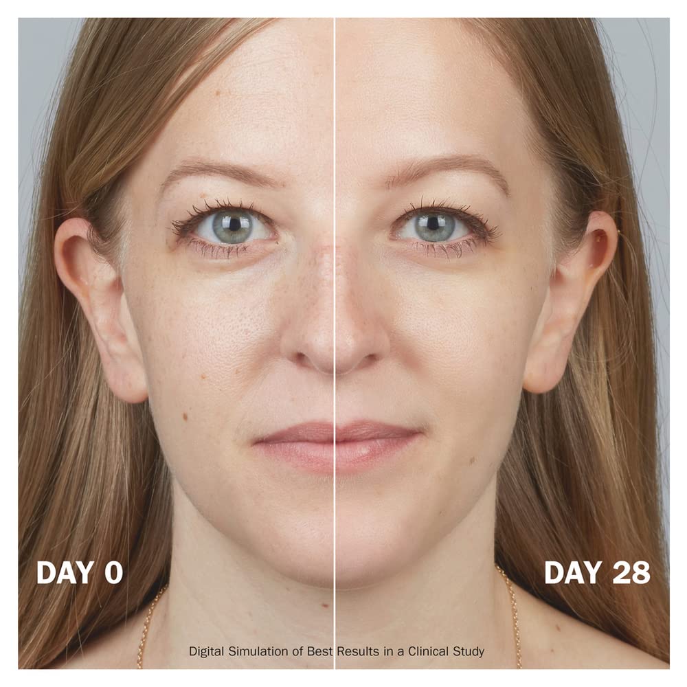 Olay Retinol 24 MAX Eye Cream With 40% More Retinol Complex, Advanced Anti-Ageing Eye Cream For Firmer Skin, Reduces Wrinkles, Fine Lines And Pigmentation, Olay's Strongest Retinoid Complex, 15 ml