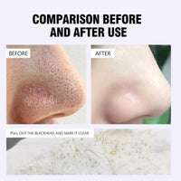 ISBEAUSOLS Blackhead Remover Mask-Salicylic Acid Nose Strips-Black Head Remover for Face-Nose Pore Strips for Remove Blackheads,Acne and Pores-60Pcs Nose Patches-Gentle Pore Strips with Vitamine C