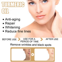 Turmeric Serum Dark Spot Removal, Ksndurn Turmeric Face Serums Oil, Turmeric Dark Spot Corrector Serum for Face & Body, Heals Scars, Moisturizing, Skin Brightening Serum for Dark Spots