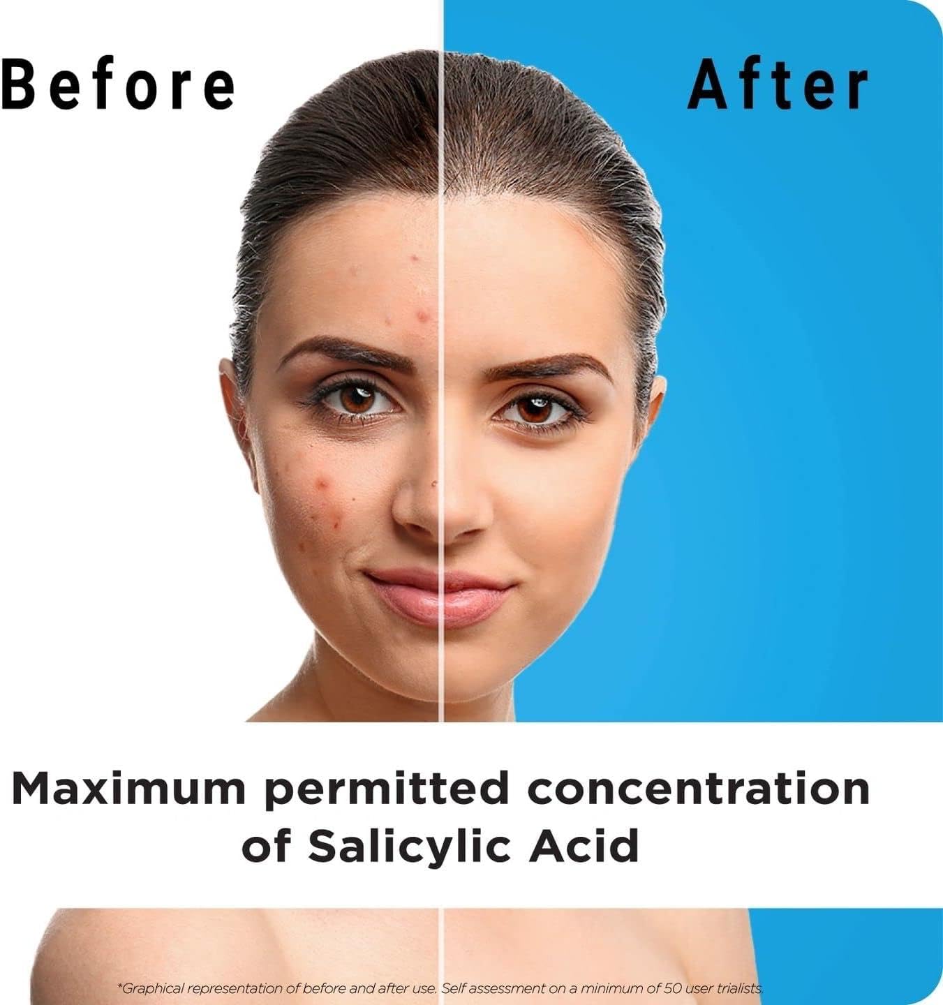 Generic Salicylic Acid Exfoliating Face Wash (Pack of 2) – Clearer Skin from Day 1 | Unclogs Pores, Controls Oil & Shine | Cruelty-Free & Dermatologist Approved