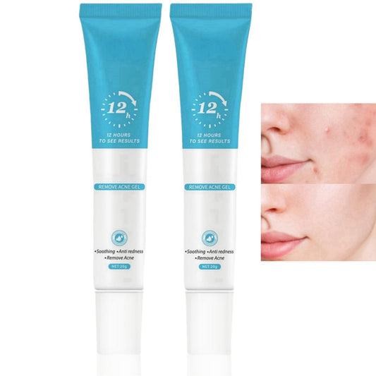 2PCS Acne Treatment Gel,Acne Cream Useful,Anti Acne Face Cream,Anti Acne Removal Cream,Acne Spot Treatment Cream,Pimple Treatment Gel Cream,Face Ance Gel,Acne Treatment Spot and Blackheads Treatment