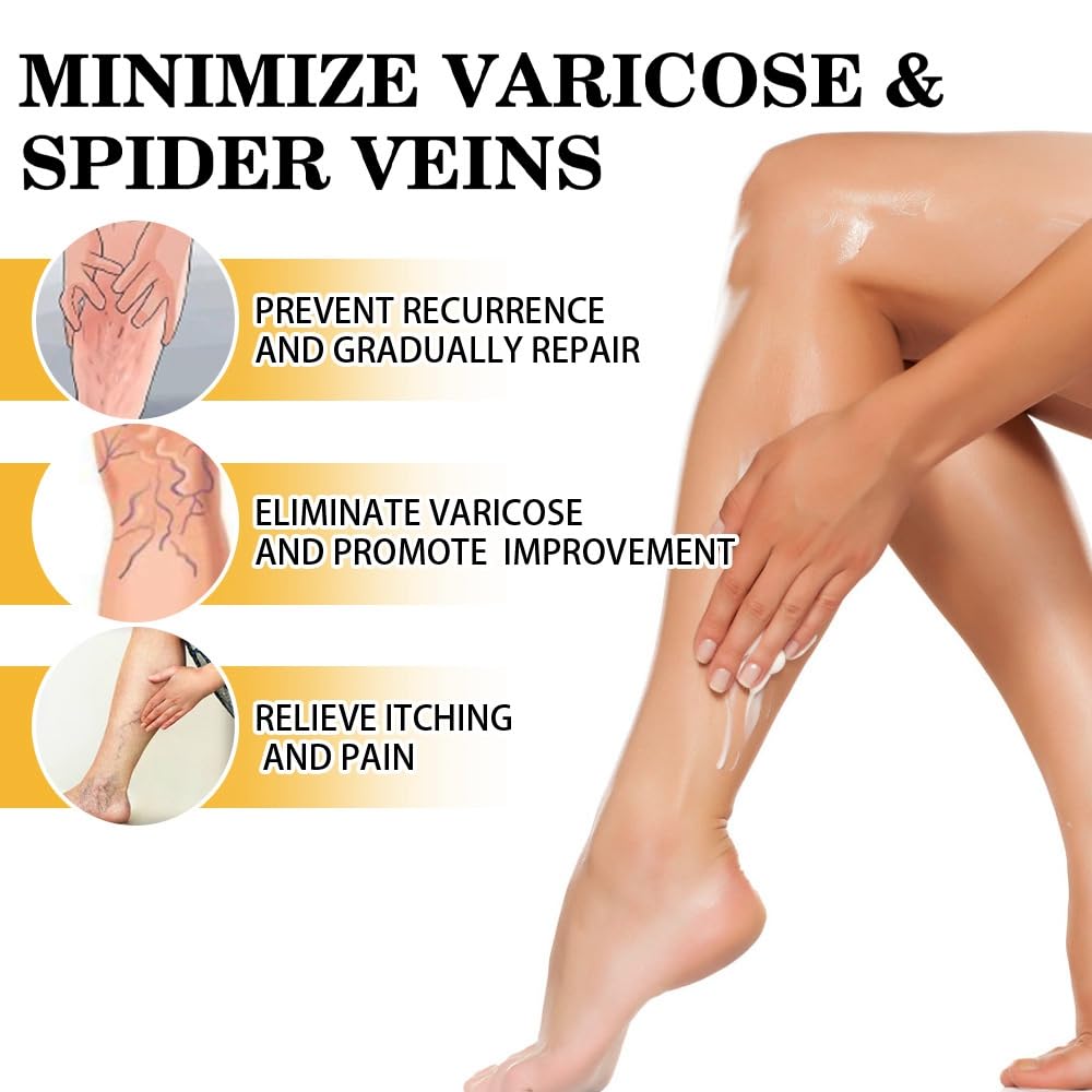Varic/ose Ve/ins Treatment for Legs,Natural Varic/ose Ve/ins Cream,Varic/ose Ve/ins Treatment Cream,Cream for Varic/ose Ve/ins in Legs,SPI/der V/eins Repair Cream,Varic/ose Ve/ins Relief Cream