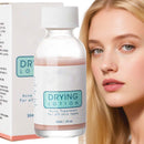 Eveloveu Anti-Acne Serum & Drying Lotion – Fast-Acting Acne Treatment to Dry Out Blemishes, Reduce Pimples & Redness. Gentle Acnecide Face Lotion for Teenage Girls, Women & Men – Clear, Healthy Skin Care