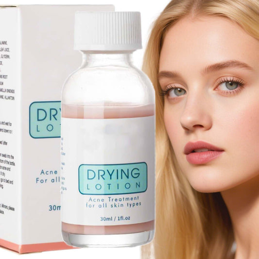 Eveloveu Anti-Acne Serum & Drying Lotion – Fast-Acting Acne Treatment to Dry Out Blemishes, Reduce Pimples & Redness. Gentle Acnecide Face Lotion for Teenage Girls, Women & Men – Clear, Healthy Skin Care