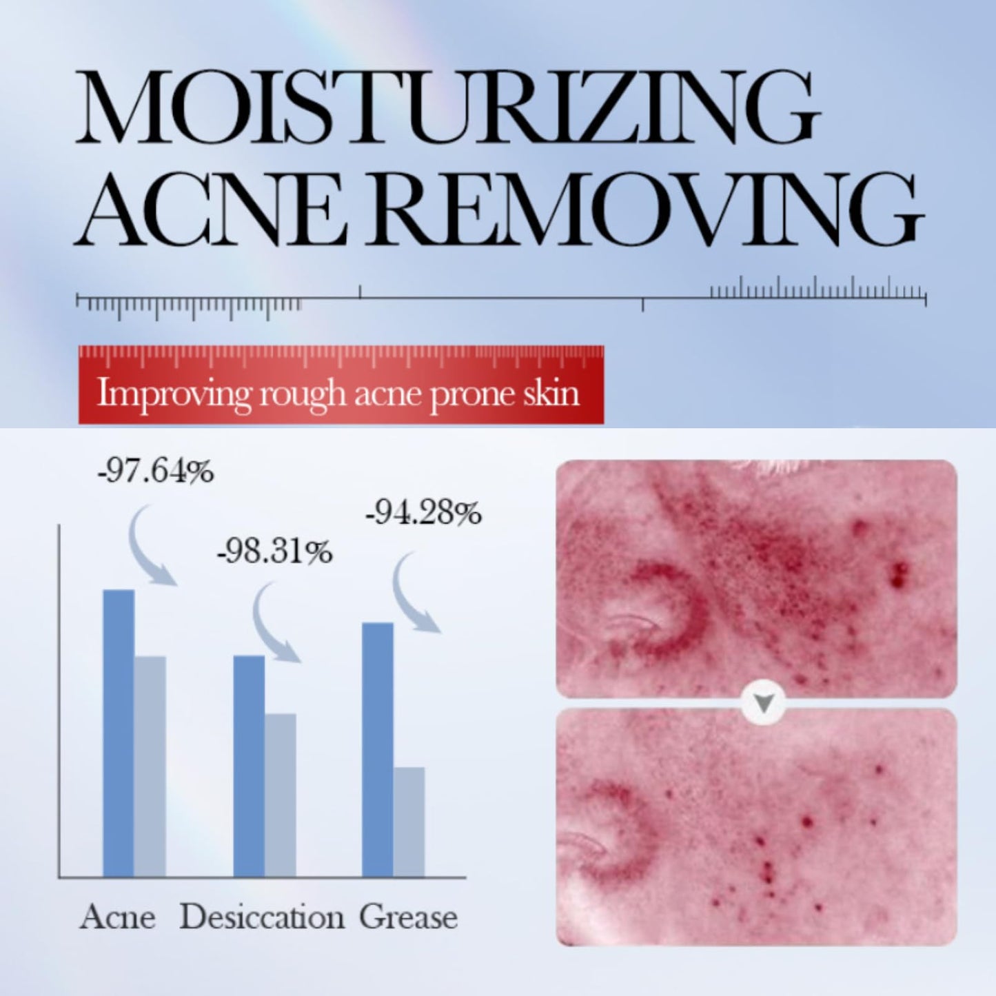 Acne Spot Treatment Cream-Dark Spot Remover for Face-Dual-Power Salicylic Acid & Niacinamide Acne Treatment- Scar Removal Cream for Women & Men, Hyperpigmentation Treatment