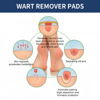 Xunzhi 24pcs Wart Treatment Patch,Corn Remover Pads,Verruca Treatment Corn Plasters,Foot C/ORN Remover Patch C/ORN,Wart R/emover,Co/rn Callus R/emover,Pain Relief W/Art Plaster,Co/rn Plasters for Toes