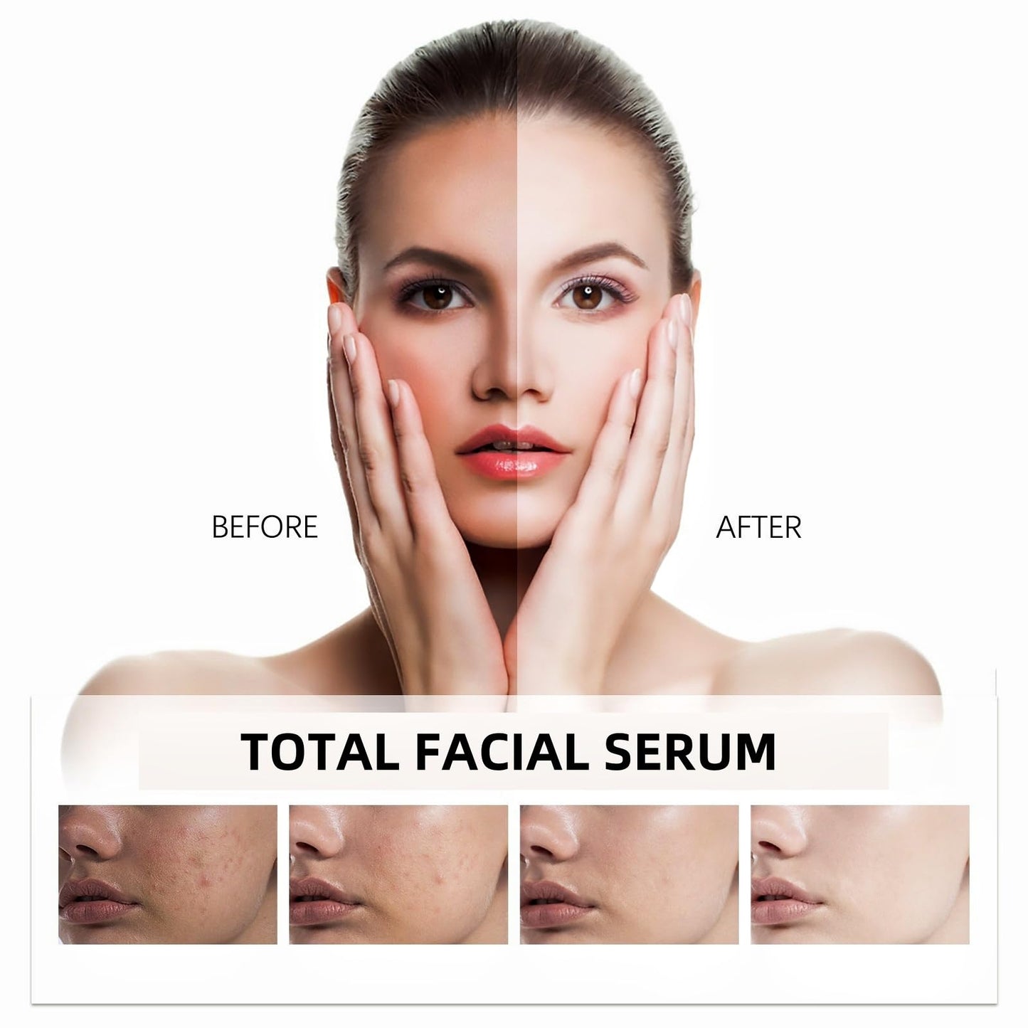 QinZiEn Total Package Serums,Hyaluronic Acid Serum,Hydrating Serum,Face Moisturisers,Collagen Ser-um for Face,Hyaluronic Acid Moisturiser,Anti Wrinkle Ser-um,Anti Aging Se-rum,Moist-uriser for Dry Skin Fac-e