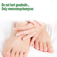 7 Days Nail Fungus Treatment,Ginger Nail Treatment,Fungal Nail Treatment,Toenail Fungus Treatment Extra Strength,Fungal Nail Treatment for Toenails Extra Strong,Nail Repair,Nail Growth Serum,50ml