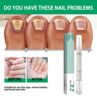 2 Pack Nail Repair Pen, 4ml Nail Care Liquid - Nail Strengthener, Cuticle Oil, Help Strengthen The Nails