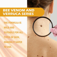 ALLILUYAA 2PCS LIPOGO Bee Venom Cream, Lipogo Professional Bee Venom Cream Gel for All Skin Types