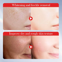AurolaGlow Kojic Acid Cream – Brightening & Anti-Aging Dark Spot Remover – Hydrating Face Moisturizer for Dry Skin – Anti-Wrinkle Cream for Women – 50g
