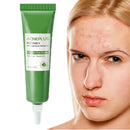 Anti Acne Face Cream,Gentle Acne Cream for Acne Prone Skin,Anti Acne Removal Cream with Plant Extract,Moisturiser Face Cream for Acne Mark,Fade Acne Mark & Calm Acne Redness,Scar Removal Cream