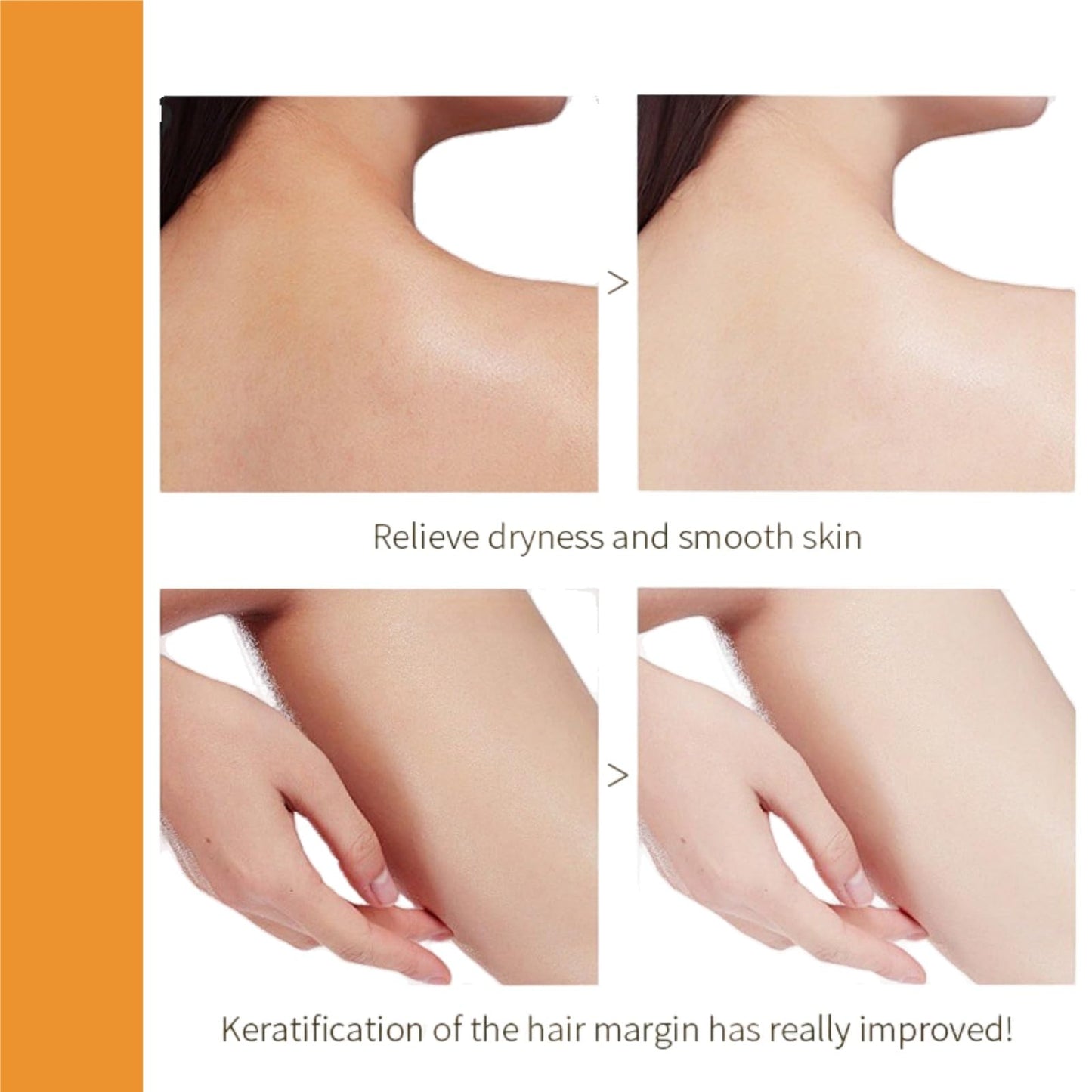 Orange Enzymes Exfoliating Gel,Orange Peeling Gel,Facial Scrub Exfoliating Cleanser,Face and Body Exfoliati/ng Scrub Ge/l,Deep Exfolia-ting Cleanser,Face Exfoliator,Whitening Deep Exfoliator