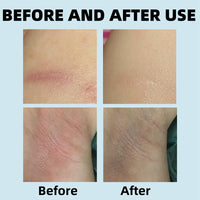 Fankayi 2PCS Anti-Chafe Stick,Waterproof Anti Chafe Stick,Glide Anti Chafing Stick,Thigh Anti Chafe Stick,Running Chafe Stick,Body Anti-Chafe Balm for Heel,Lower Arm,Legs,Skin Protection,Moisturizing