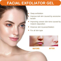 IZBEAUVO Orange Face Exfoliator,Vitamin C Facial Scrub Gel,Deep Exfoliating Face Wash,Blackhead Scrub,Orange Gel Face Scrub Brightening Skin,Soft Your Skin and Remove Dead Skin For Smooth & Radiant