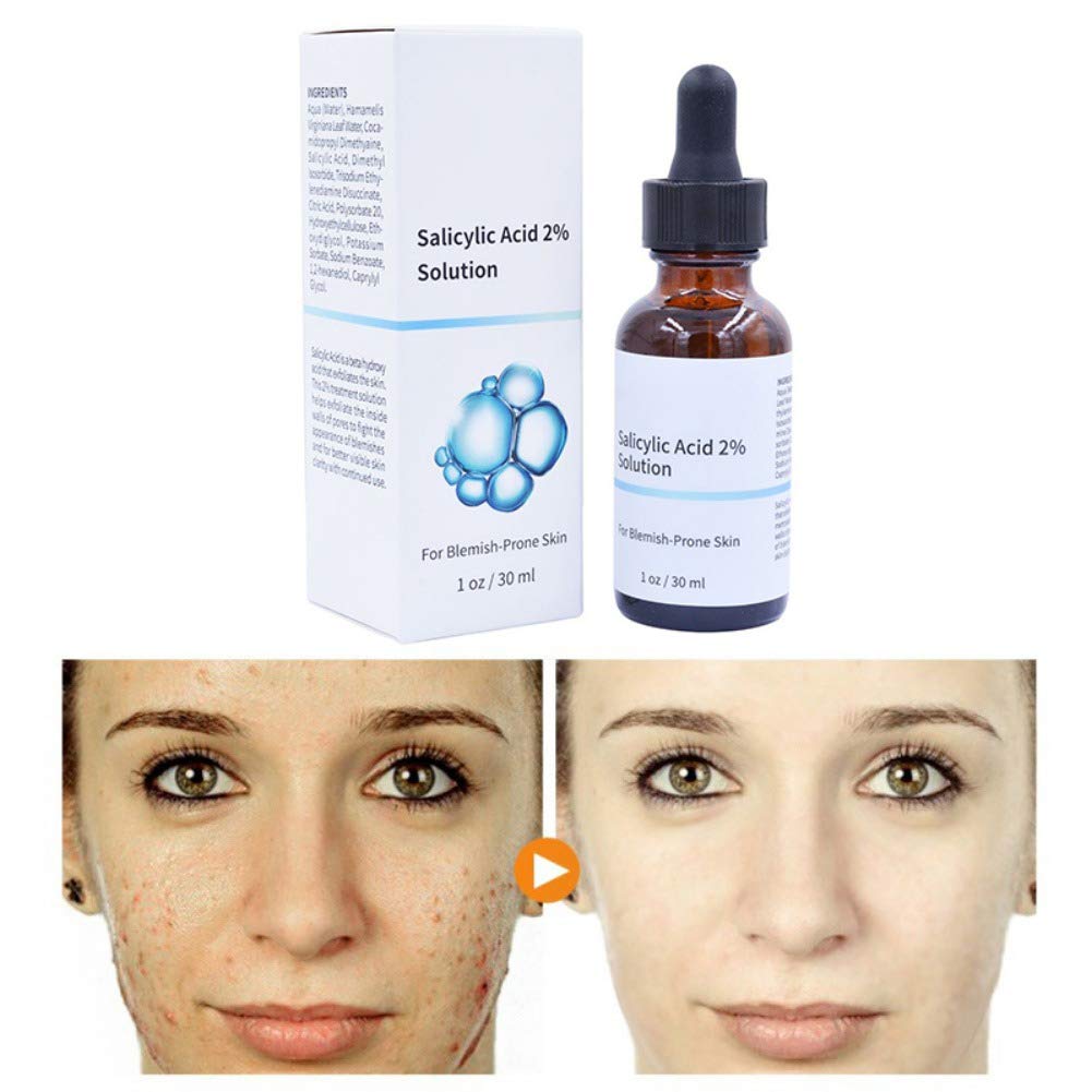 Salicylic Acid Concentrate Super Strong 2% - Acne Spot Treatment - Professional Skincare Serum