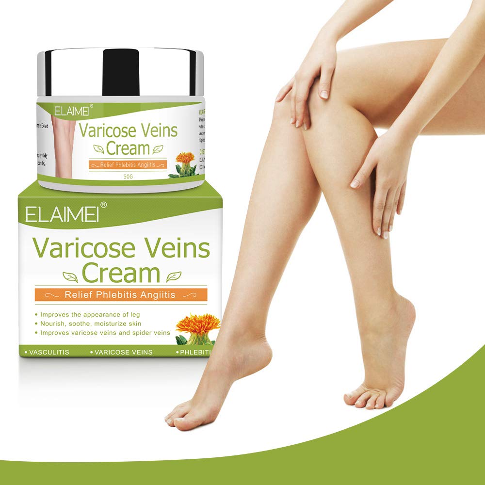 Solotree Varicose Veins Cream, Varicose Vein Treatment, Spider Vein Treatment Cream for Legs, Improve Blood Circulation, Tired and Heavy Legs Fast Relief