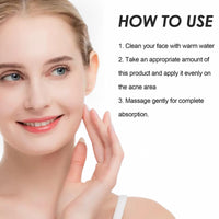 1PCS Acne treatment gel, Anti-Acne Cream, Spot Treatment Pimple Cream,Moisturizing gel for relieving and soothing redness, Acne treatment and spot treatment 20g.